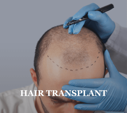 hairTransplant